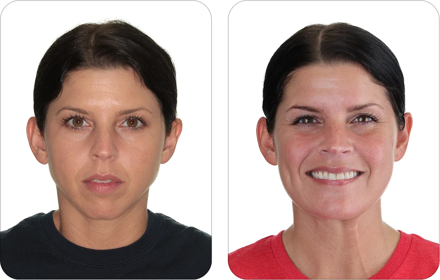 Side-by-side headshots of the same woman: left with neutral expression in a black shirt, right smiling in a red shirt.