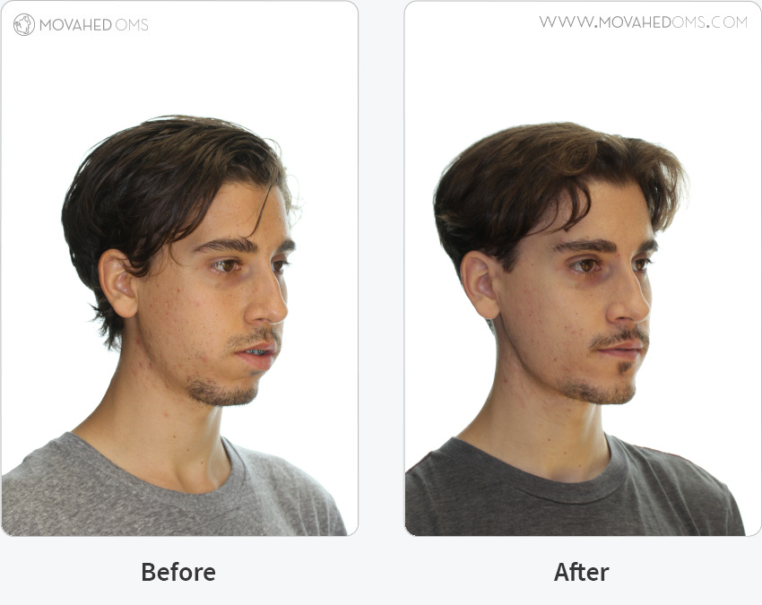 Case Study 4 Movahed OMS