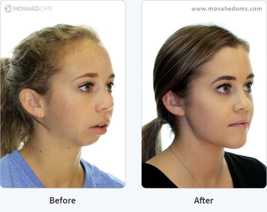 Case Study 1 Movahed OMS