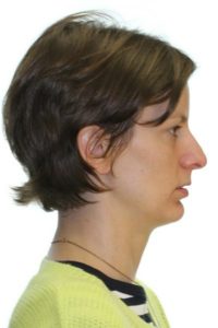 Side profile of woman before